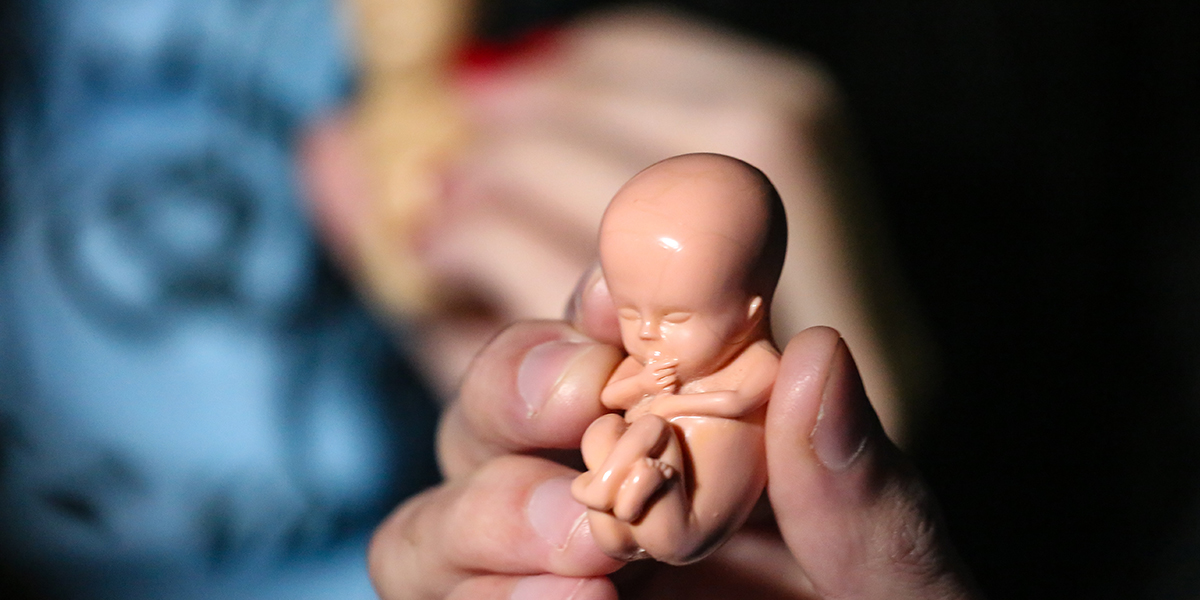 abortus foetus